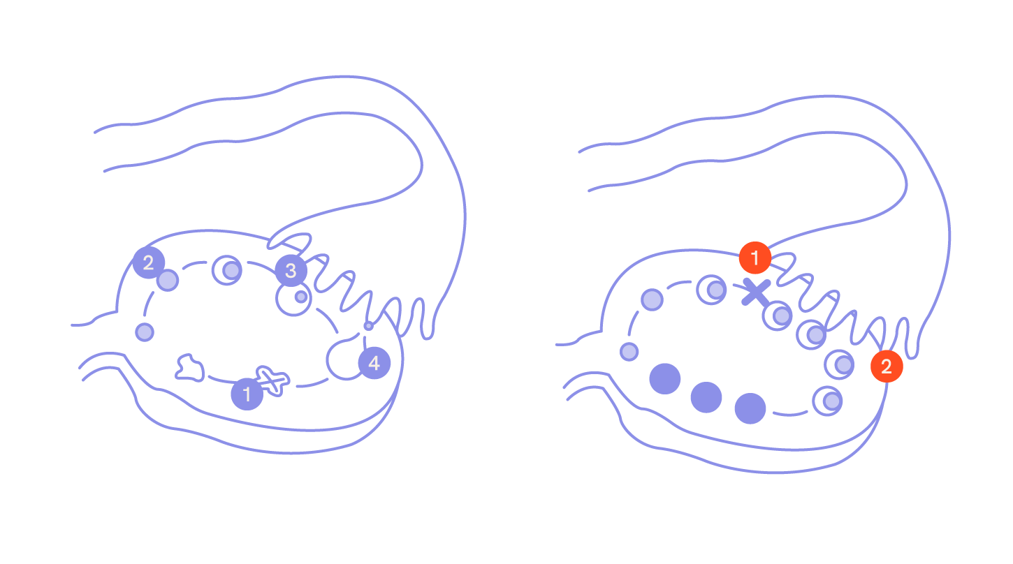 Schaubilder von physiologisch unauffälligem und polyzistischem Eierstock
