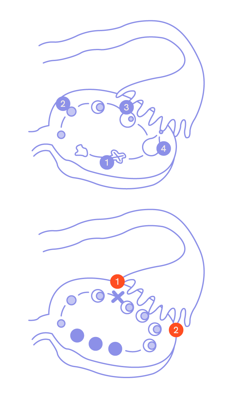 Schaubilder von physiologisch unauffälligem und polyzistischem Eierstock